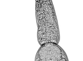 Schistosoma mansoni cercaria